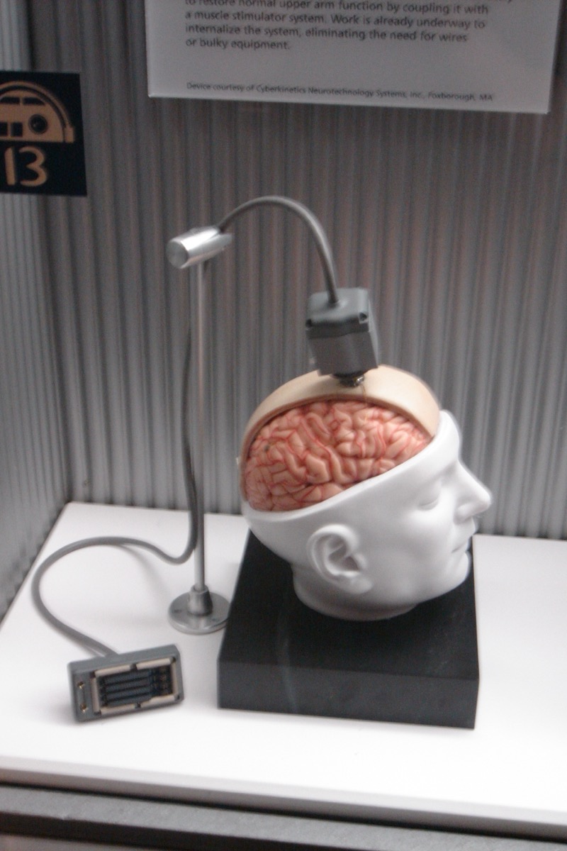 Museum display of the BrainGate system: a cut-away head model with a connector seated on the exposed brain and cabled to a stand, the grey electrode array module beside it