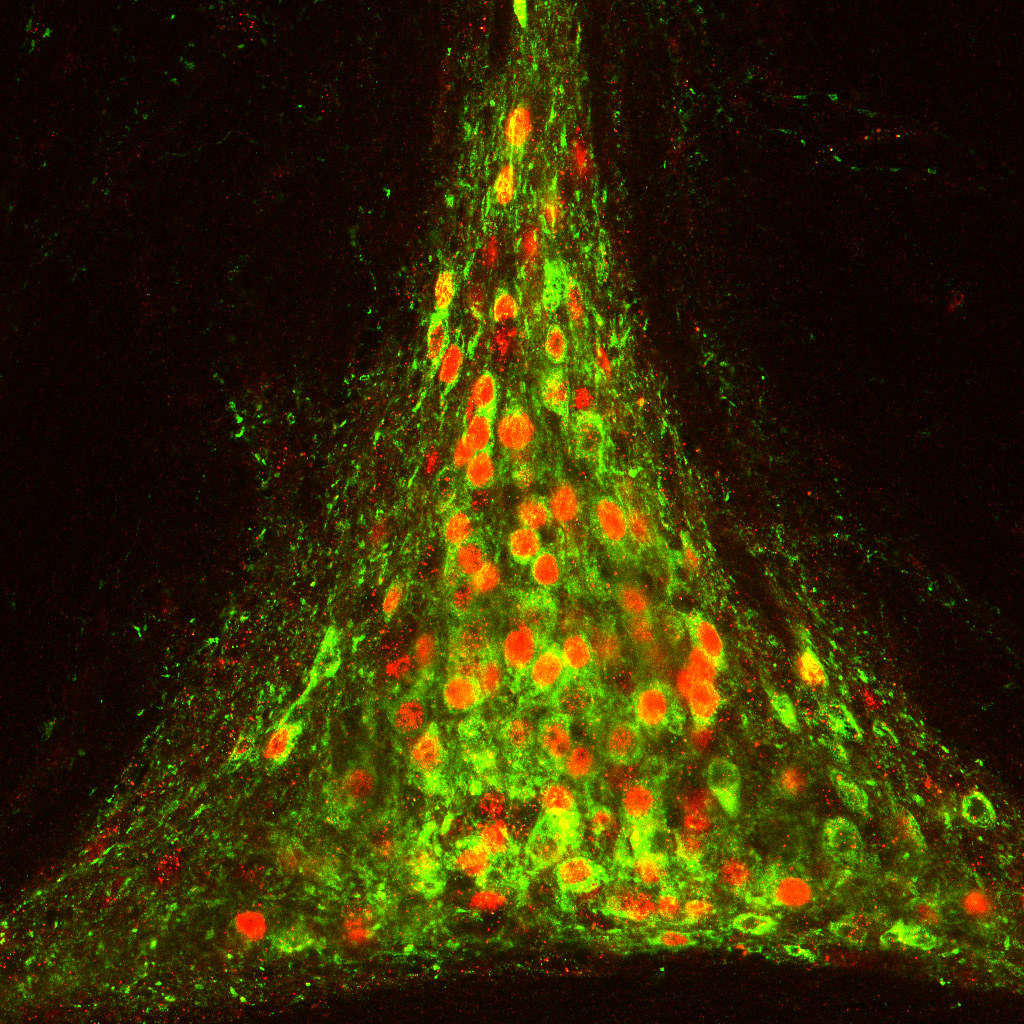 Fluorescence microscope image of thirst-circuit neurons in a mouse brain
