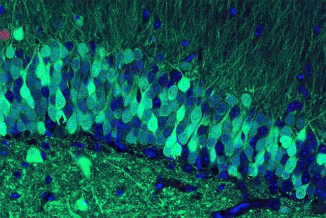Fluorescence microscope image of memory-engram neurons in a mouse hippocampus