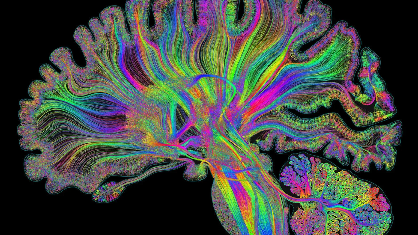 Diffusion-tractography rendering of the brain's white-matter fiber tracts, rainbow-colored by fiber direction, on a black background